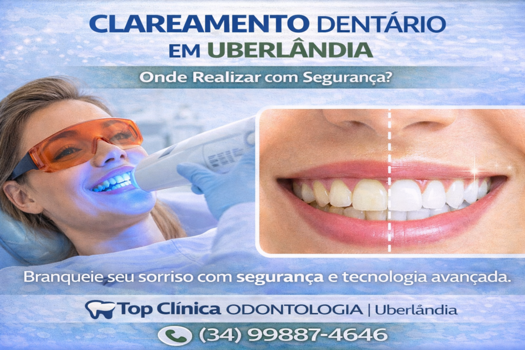 Clareamento dentário em Uberlândia realizado com segurança na Top Clínica Odontologia