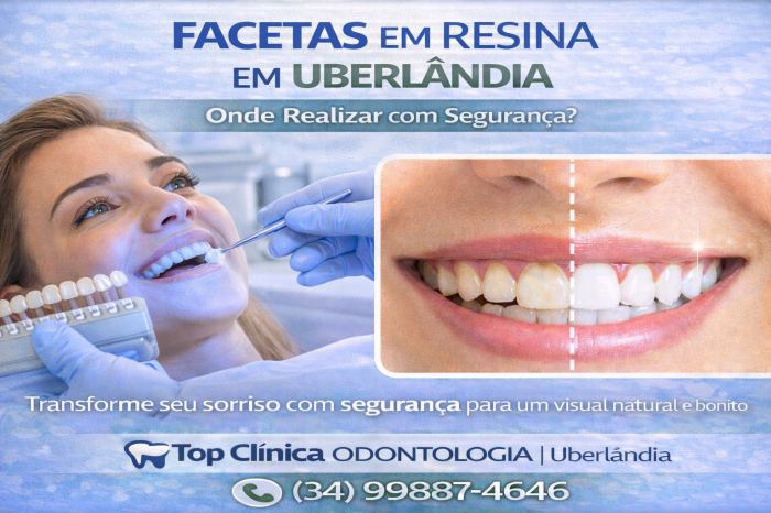 Facetas em resina em Uberlândia realizadas com segurança na Top Clínica Odontologia